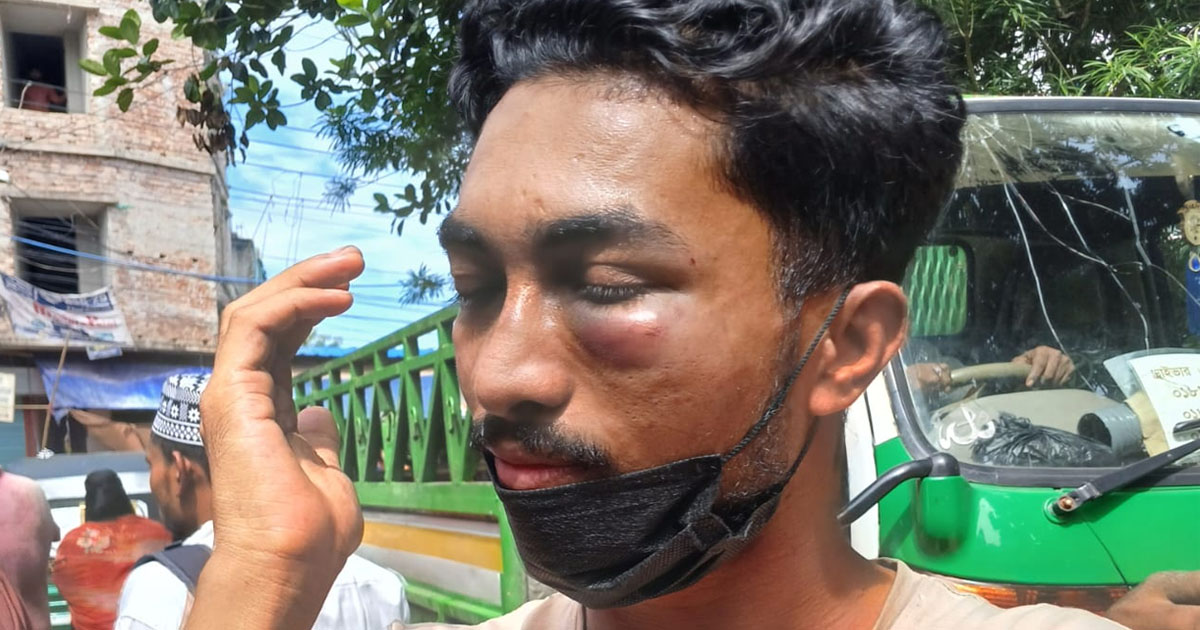 অস্ত্রের মুখে পটিয়ায় ব্যবসায়ীকে অপহরণ, পরে উদ্ধার