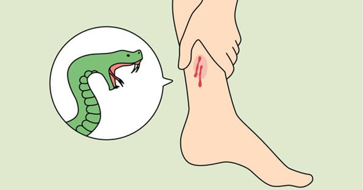 সন্দ্বীপে বিষাক্ত সাপের কামড়ে গৃহিণীর মৃত্যু