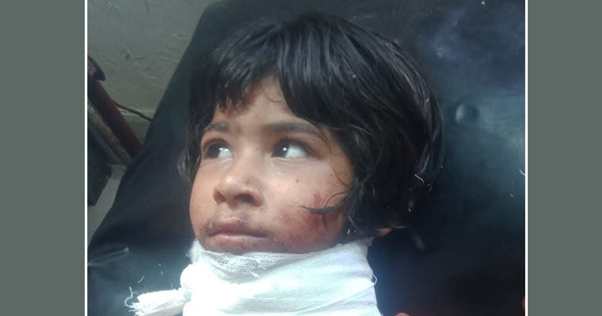 সীতাকুণ্ডে ৭ বছরের শিশু কন্যাকে গলা কেটে হত্যার চেষ্টা!