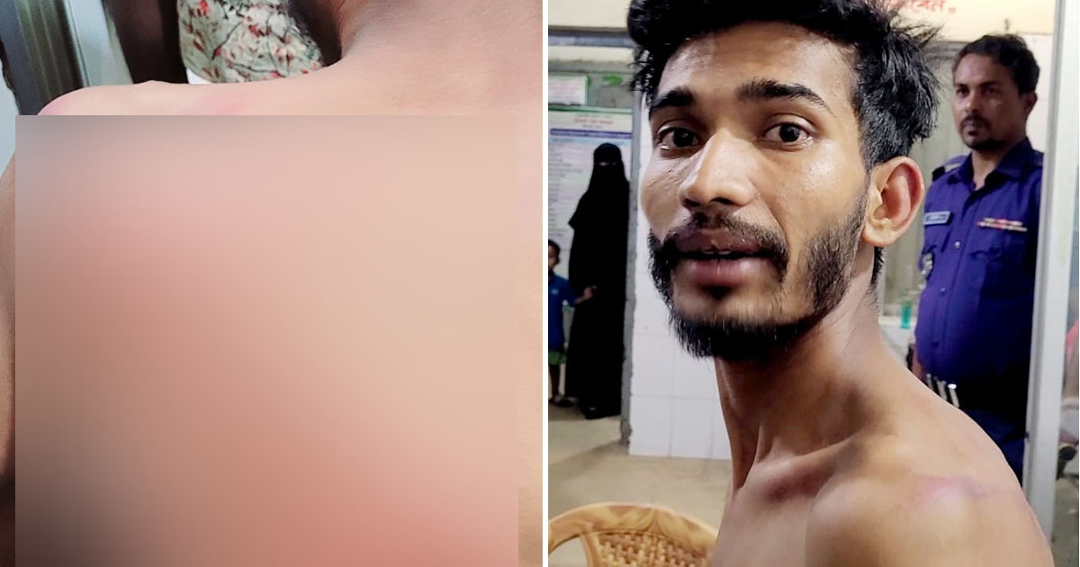 ফটিকছড়িতে মব সৃষ্টি করে চা দোকানদারকে বেধড়ক পিটুনি