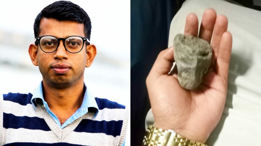 দৈনিক পূর্বকোণ - চট্টগ্রামের দৈনিক চলন্ত ট্রেনে ছোড়া পাথরে চোখ হারালেন আইনজীবী