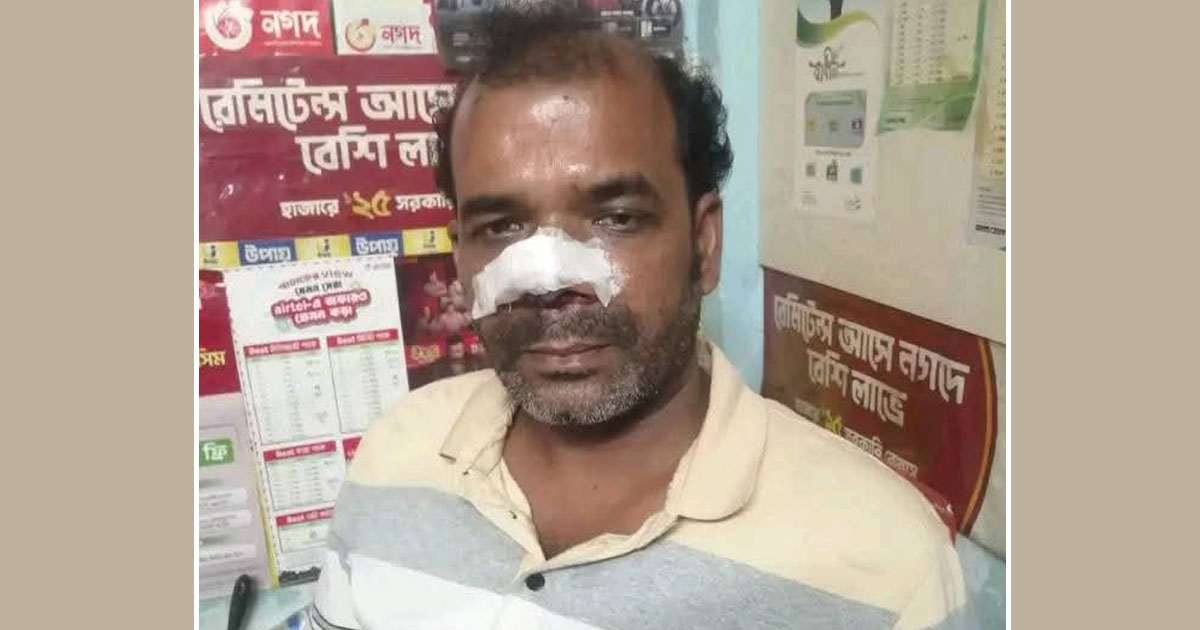 দৈনিক পূর্বকোণ - চট্টগ্রামের দৈনিক বোয়ালখালীতে ব্যবসায়ীর চোখে মরিচের গুঁড়ো ছিটিয়ে টাকা-মোবাইল ছিনতাই