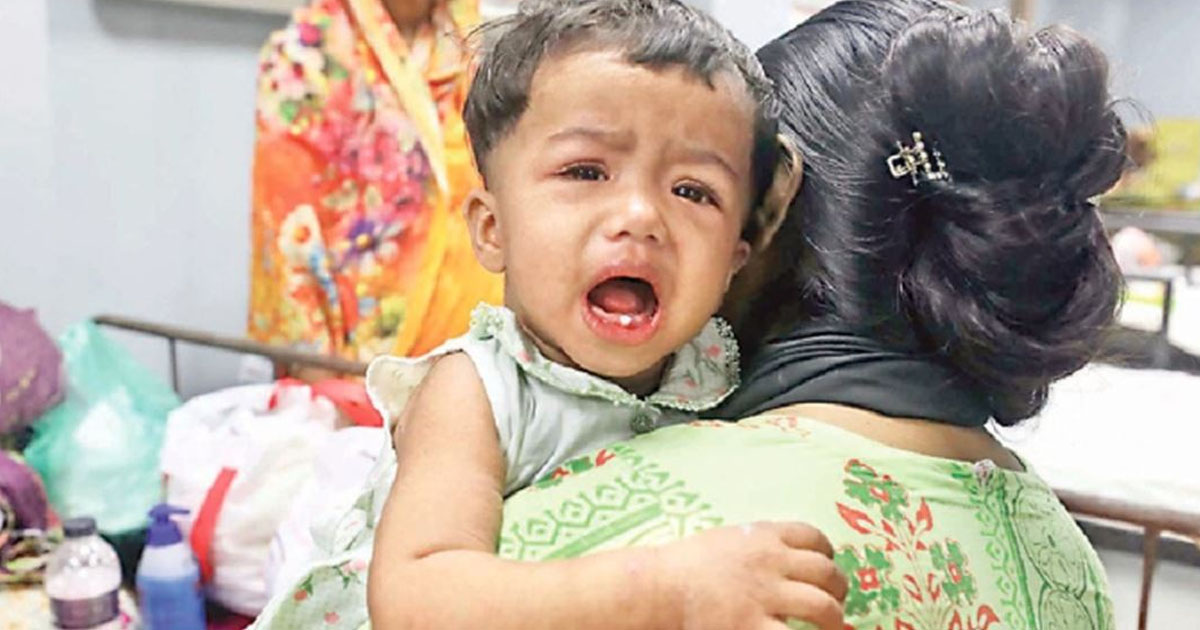 হামের উপসর্গে আরও ৬ শিশুর মৃত্যু
