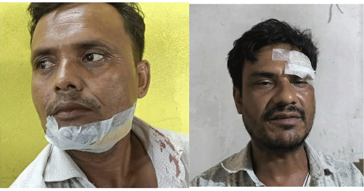 দৈনিক পূর্বকোণ - চট্টগ্রামের দৈনিক মাতামুহুরীতে পুকুরের দখল নিয়ে বিরোধ, হামলায় আহত ৩