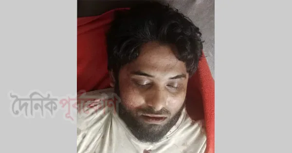 দৈনিক পূর্বকোণ - চট্টগ্রামের দৈনিক উখিয়ায় সন্ত্রাসীদের গুলিতে আরসা সদস্য নিহত