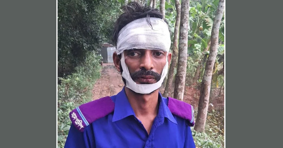দৈনিক পূর্বকোণ - চট্টগ্রামের দৈনিক বোয়ালখালীতে গ্রাম পুলিশের মাথা ফাটালো দুর্বৃত্তরা