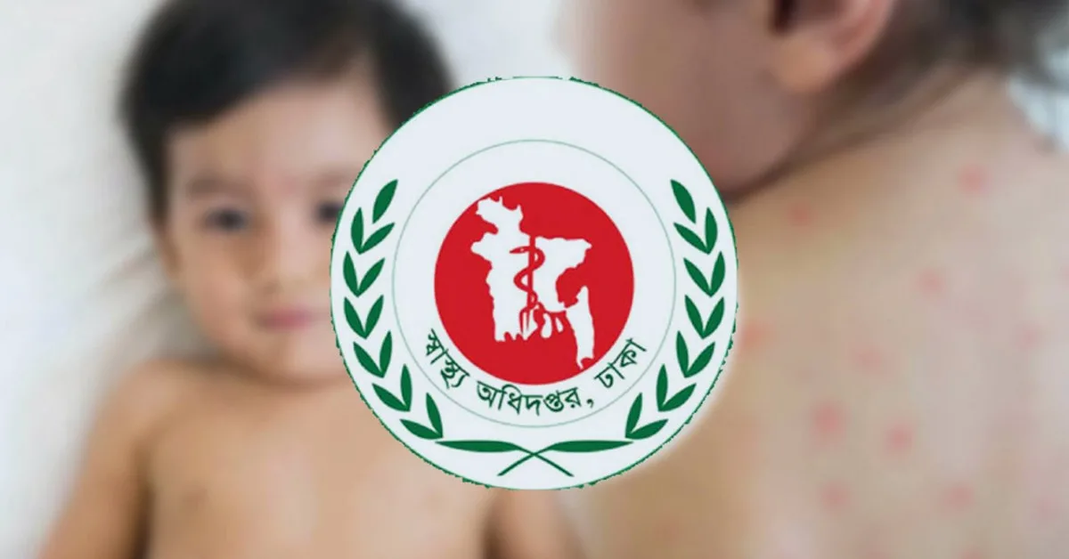দৈনিক পূর্বকোণ - চট্টগ্রামের দৈনিক হামের উপসর্গ নিয়ে আরও ৪ শিশুর মৃত্যু