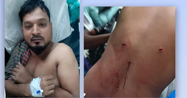 দৈনিক পূর্বকোণ - চট্টগ্রামের দৈনিক রাঙ্গুনিয়ায় ব্যবসায়ীর সহকারীকে অপহরণ করে ১৩ লাখ টাকা ছিনতাই