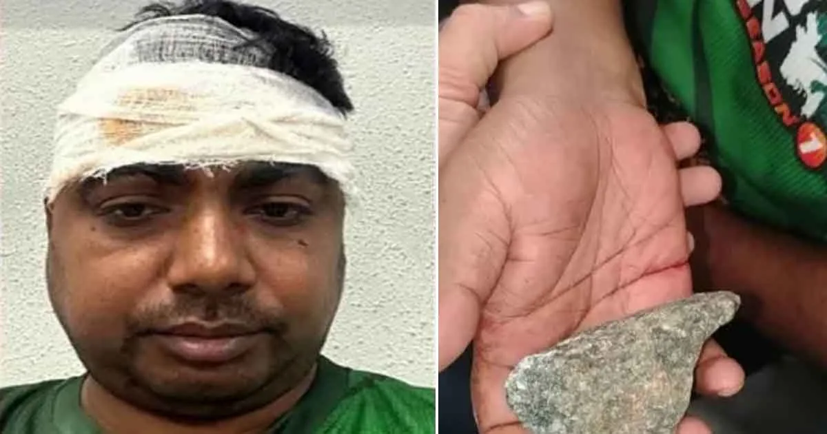 দৈনিক পূর্বকোণ - চট্টগ্রামের দৈনিক কক্সবাজার এক্সপ্রেসে ছোড়া পাথরে মাথা ফাটলো যাত্রীর