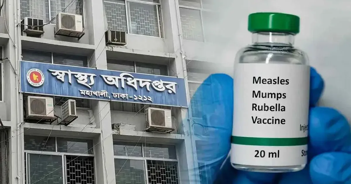 দৈনিক পূর্বকোণ - চট্টগ্রামের দৈনিক হাম উপসর্গে চট্টগামে দুজনসহ ৬ মৃত্যু, আক্রন্ত ১ হাজার ৩৯৩